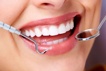 Cosmetic Dentistry