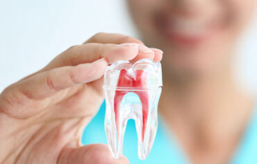 Painless Root Canal Treatment