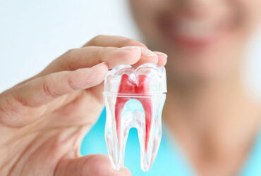 Painless Root Canal Treatment