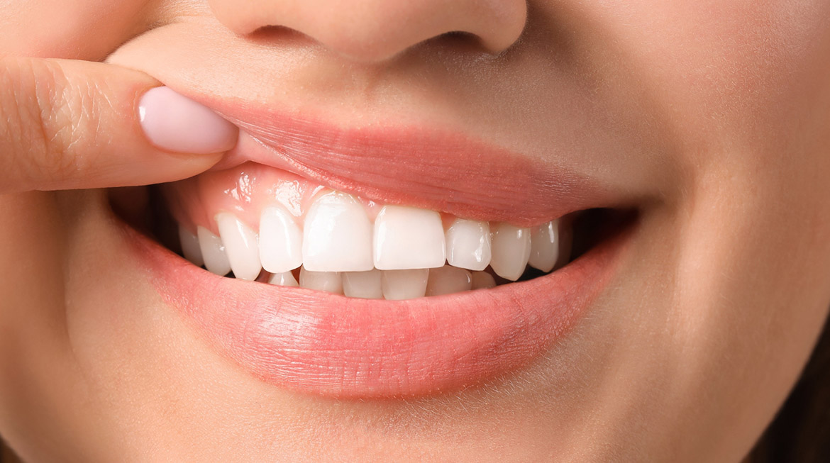 Is Having a Gum Lift Really Necessary for Your Oral Health?