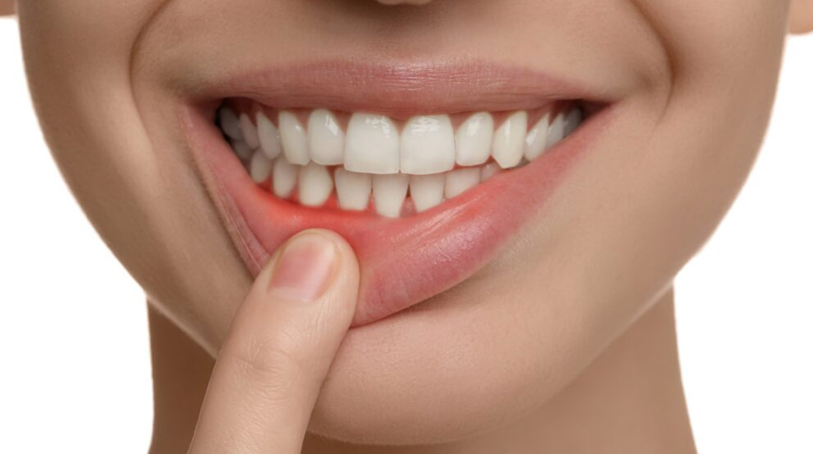 The Correct Way Recommended to Take Care of Your Gums