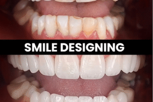 Smile with Confidence: Why Dent Arcs is Revolutionizing Dental Care in Ludhiana and Greater Noida