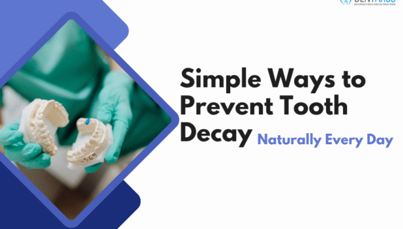 Simple Ways to Prevent Tooth Decay Naturally Every Day