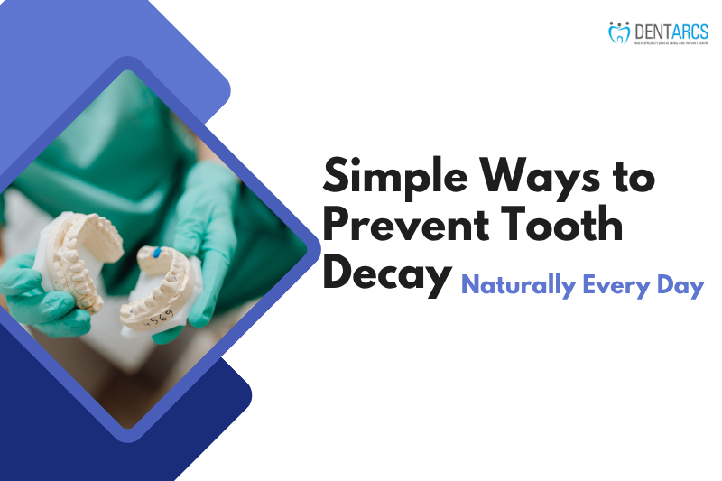 Simple Ways to Prevent Tooth Decay Naturally Every Day