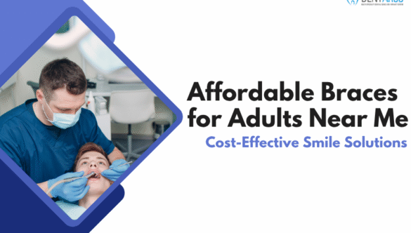 Affordable Braces for Adults Near Me | Cost-Effective Smile Solutions