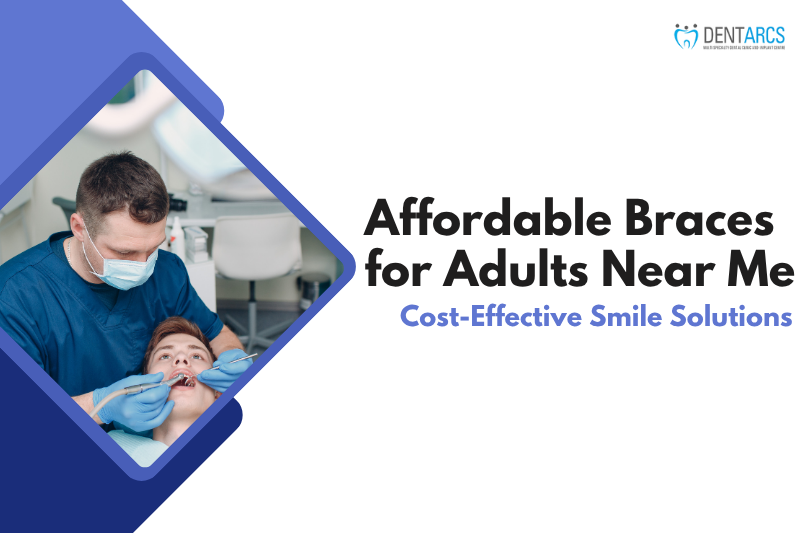 Affordable Braces for Adults Near Me | Cost-Effective Smile Solutions
