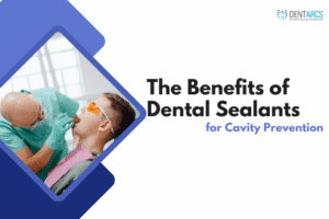 The Benefits of Dental Sealants for Cavity Prevention
