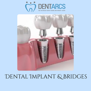Dentarcs Dental Care