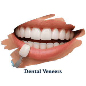 dentarcs dental care-Dental Veneers