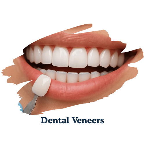 dentarcs dental care-Dental Veneers