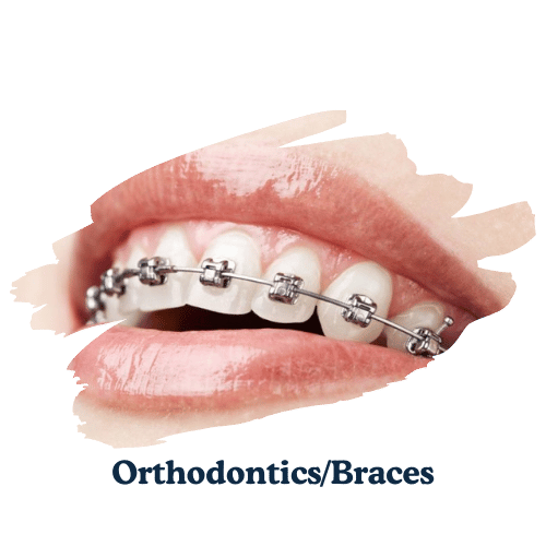 dentarcs dental care-Orthodontics_Braces