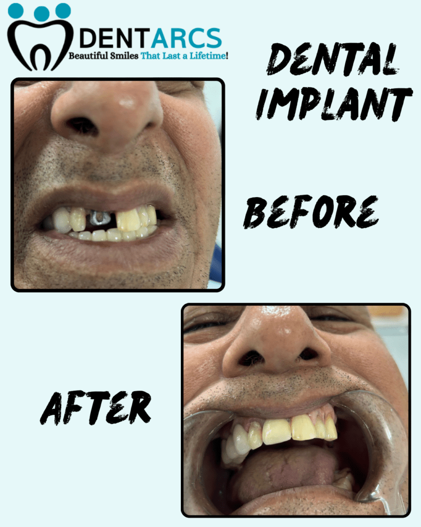 DENTARCS Dental care