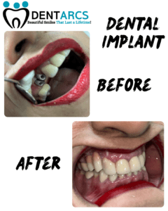 dentarcs dental clinic