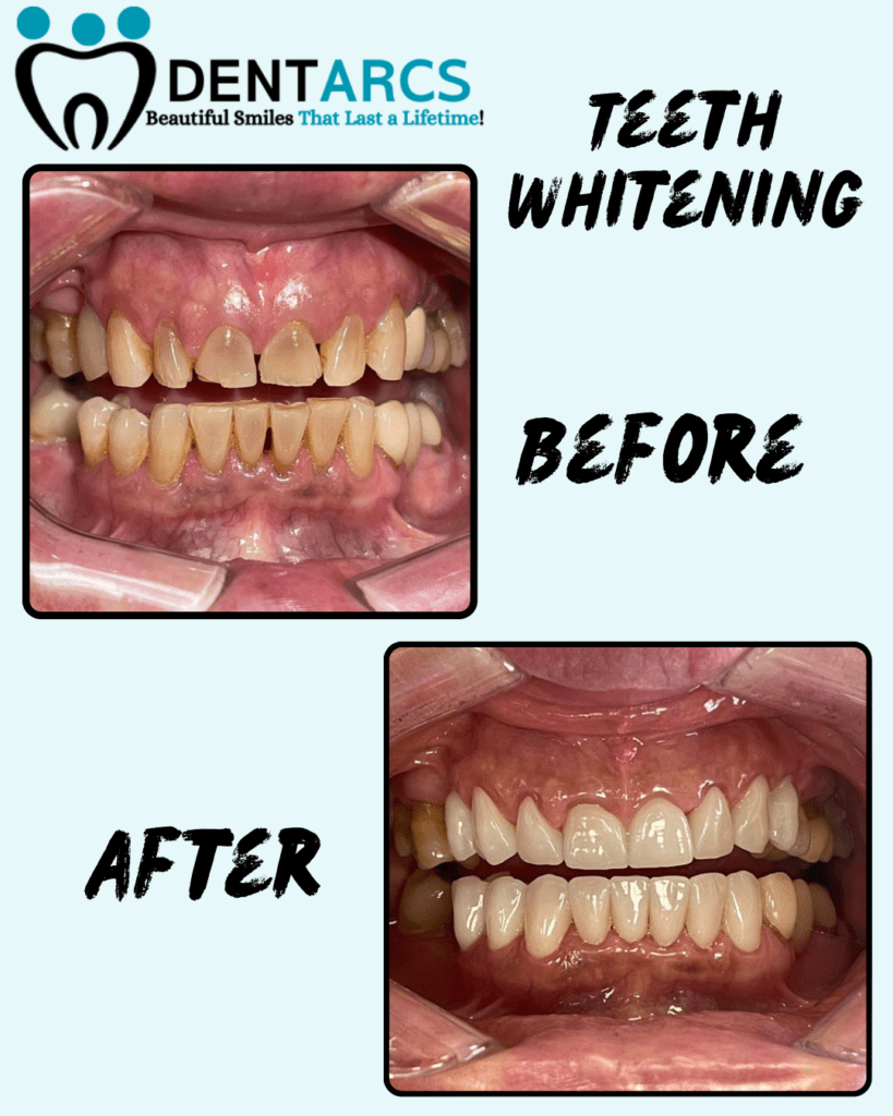 DENTARCS Dental care