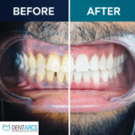 Dentarcs Dental Clinic